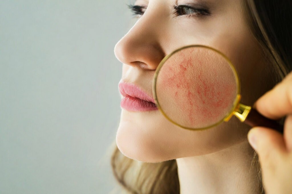 Borkenflechte verstehen und behandeln – Ursachen, Symptome und Tipps borkenflechte